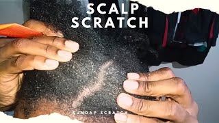 SCALP SCRATCHING 101 Scratching My Scalp  Part 1 [upl. by Olleina]