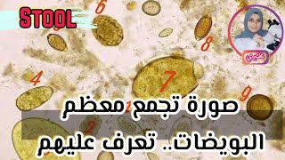 كل انواع الطفيليات في عينات البراز الجزء الاول البويضات ovas in stool samples [upl. by Anet]