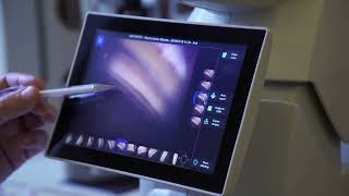 Automated Gonioscopy  Short product introduction [upl. by Saylor]