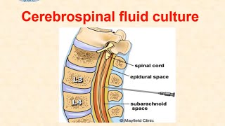 Cerebrospinal fluid culture  dr Ismail [upl. by Notgnirrac394]