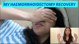 MY HAEMORRHOIDECTOMY EXPERIENCE  PART2  RECOVERY TIME [upl. by Rider]