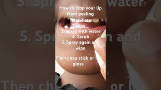 How to stop your lip from peeling [upl. by Nidia]