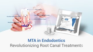 ROLE OF MTA IN ENDODONTICS dental dentalkart waldentMTA EndolifeMTA [upl. by Gile]