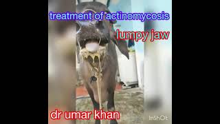 treatment of actinomycosis l symptoms of actinomycosis l dr umar khan [upl. by Llenoil]