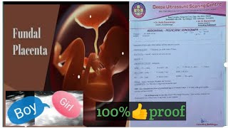 fundal anterior placenta baby gender mothervlogs57 [upl. by Ahtabat]