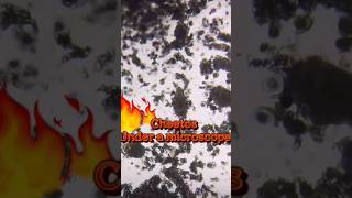 ഞാന്‍ ഞെട്ടി Cheetos under microscope forwarded message സത്യമാണോ [upl. by Irvin897]