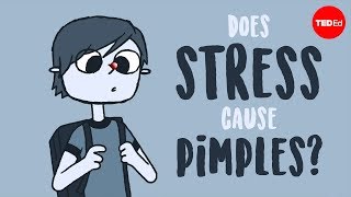 Does stress cause pimples  Claudia Aguirre [upl. by Nevah]