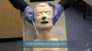 Nasotracheal Intubation [upl. by Cad]