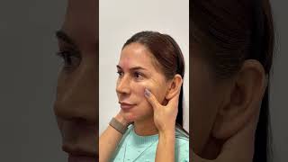 ELA NAO ACREDITOU NO RESULTADO rejuvenescimentofacial hof bioestimuladordecolageno protocoll [upl. by Amek]