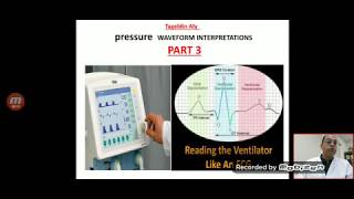 Part 3 pressure time waveform interpretation analysis display pitfalls ventilator graphics analysis [upl. by Emmer825]