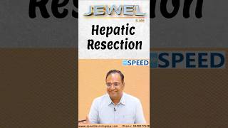 Hepatic Resection by DrKVinayak Senthil neetss iniss medico neetpg [upl. by Nils]