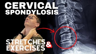 Cervical Spondylosis Neck Arthritis Stretches amp Exercises  Dr Jon Saunders [upl. by Aihsemak]