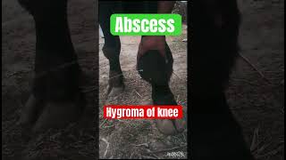 Hygroma of knee l Dr Umar Khan [upl. by Aikcir]