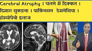 Cerebral Atrophy । चलने में दिक्कत । दिमाग सुकड़ना । पार्किनसन । डेमनेसिया । होम्योपैथी इलाज [upl. by Rammus]