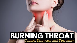 What Causes Burning Throat and its Treatment [upl. by Ragucci]