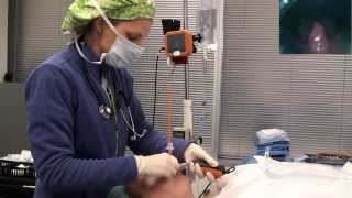 Video laryngoscope Tracheal intubation with Bougie Port [upl. by Federica817]