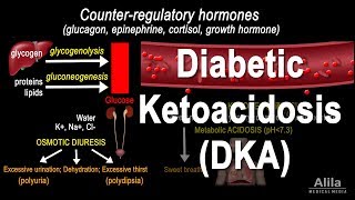 Diabetic Ketoacidosis DKA Pathophysiology Animation [upl. by Trenna]