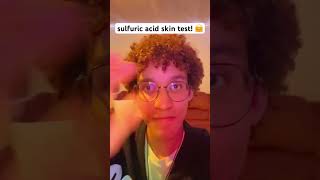 sulfuric acid skin test 🤗🧪 shorts memes funny [upl. by Seniag]