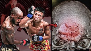 Broke His Opponents Bones The Scariest Muay Thai Fighter Ever  Rodtang Jitmuangnon [upl. by Alvita]