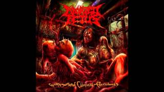 Aborted Fetus  Goresoaked Clinical Accidents FULL ALBUM [upl. by Onairda]