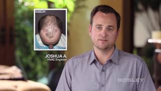 Bosley Hair Transplant Patient Review  Josh A [upl. by Enneiviv]