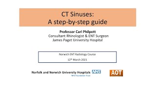 Rhinology  CT Sinuses A stepbystep guide  Prof Carl Philpott [upl. by Naji357]