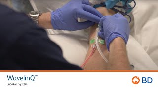 BD WavelinQ™ EndoAVF Cannulation Training [upl. by Rennoc262]