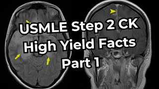 USMLE Step 2 CK High Yield Facts Part 1 [upl. by Athalie]