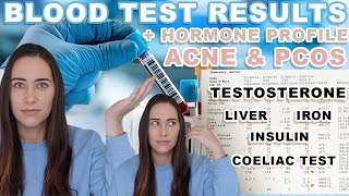 ITS MY LIVER Blood Test Results  Hormone Test for Hormonal Acne amp PCOS [upl. by Lorenza]