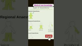 Types of anaesthesia medicostudent anaesthesia new viral shorts [upl. by Wilona]