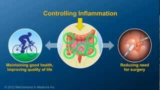 Chronic Inflammation in IBD and How AntiTNF Therapy Works [upl. by Ahsimet950]