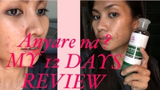 BEAUTY OBSESSION TAWAS CALAMANSI amp MIRACLE CREAM REVIEW  ANYARE ON MY 12 DAYS  PART 2 [upl. by Mosora]