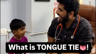 What to do in Tongue tie👅 tonguetie tongue speechdelay ankyloglossia [upl. by Allx]