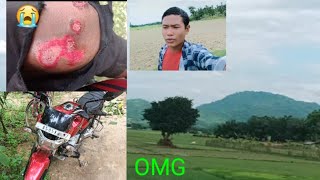 OMG V15 Bike accident crash  Bikram Vlogs 🙏😭😭😭😭😭 [upl. by Noerb]