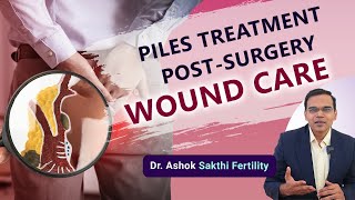 Piles Treatment Post  Surgery Wound Care  Piles அறுவை சிகிச்சை பிந்தைய பராமரிப்பு  Dr Ashok [upl. by Reppiks]