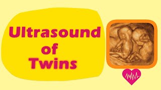 Sonography of Twins [upl. by Rosalynd]