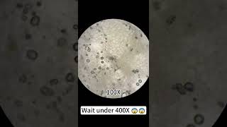 quotBroccoli at 400X is totally coolquot underthemicroscope microscope science [upl. by Neuburger]