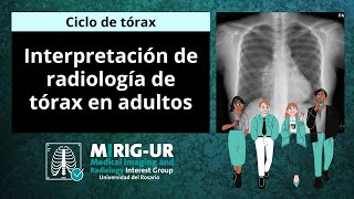 Interpretación de Radiografía de Tórax en Adultos  MIRIGUR [upl. by Priestley96]