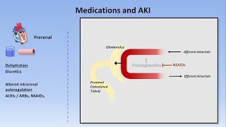 Acute Kidney Injury Part 13  Definitions and Etiologies [upl. by Sylvia]