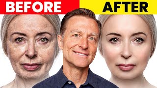 The Ultimate Face Transformation–Dr Bergs Best Remedy for Dry Skin and Wrinkles [upl. by Adora158]