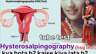 My hsg test experienceworst experience with tube test painful hsgtest viralvideo [upl. by Nyrhtak708]