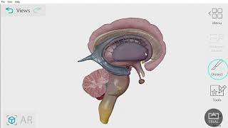 Corpus Callosum dan Ganglia Basalis [upl. by Ermey]