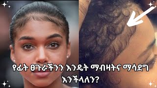 baby hair  የፊት ለፊት ፀጉራችንን እንዴት ማብዛት እንችላለን habeshaselfcare how to grow your edges [upl. by Boutis]