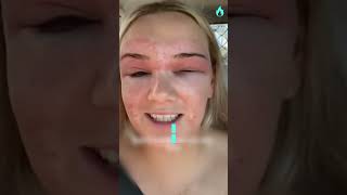 Allergic Reaction Before My Wedding Day 😱 [upl. by Quick]