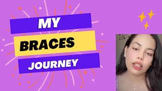 My Braces journey braces bracesjourney orthodontics timelapse transformation trending youtube [upl. by Rozelle]