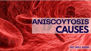 Anisocytosis Causes [upl. by Nuahsar]