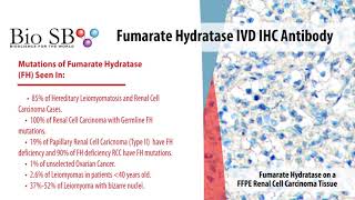 Bio SB  2021 New Fumarate Hydratase Antibody for IHC [upl. by Casimir]