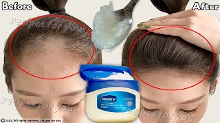 How to use Vaseline for double hair growth your hair will grow 3 times faster [upl. by Rumney]