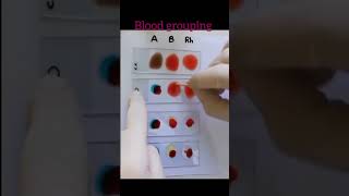 Blood grouping by slide method shorts abobloodgroup [upl. by Ruthanne456]