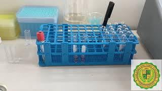 Glucose Measurment using Spectrophotometer [upl. by Boyce840]